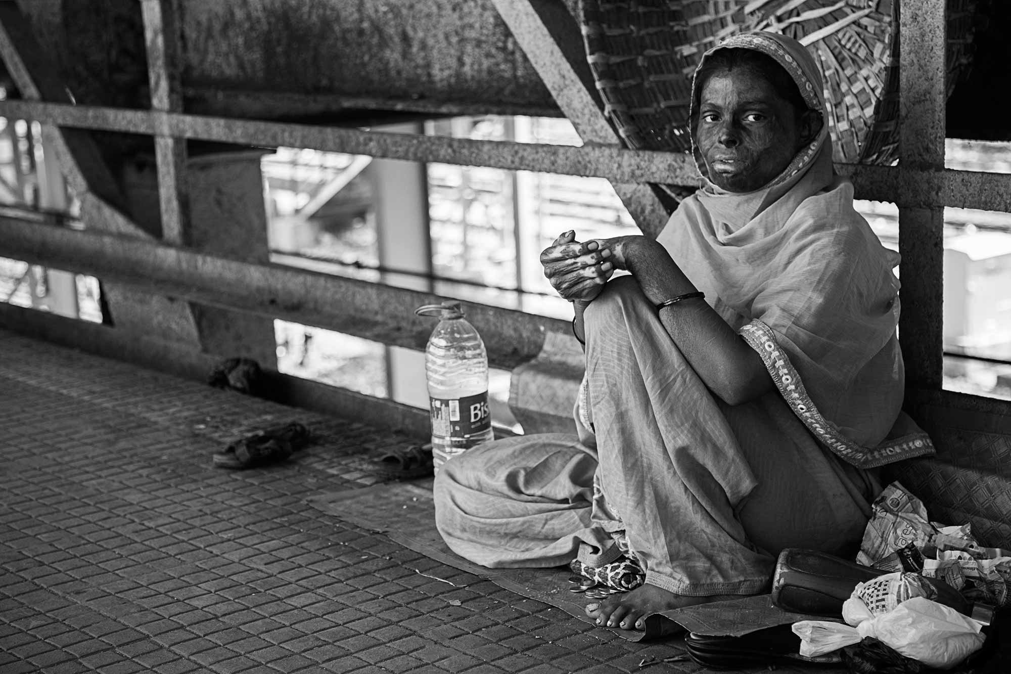 acid-victim-woman-streets-mumbai-india