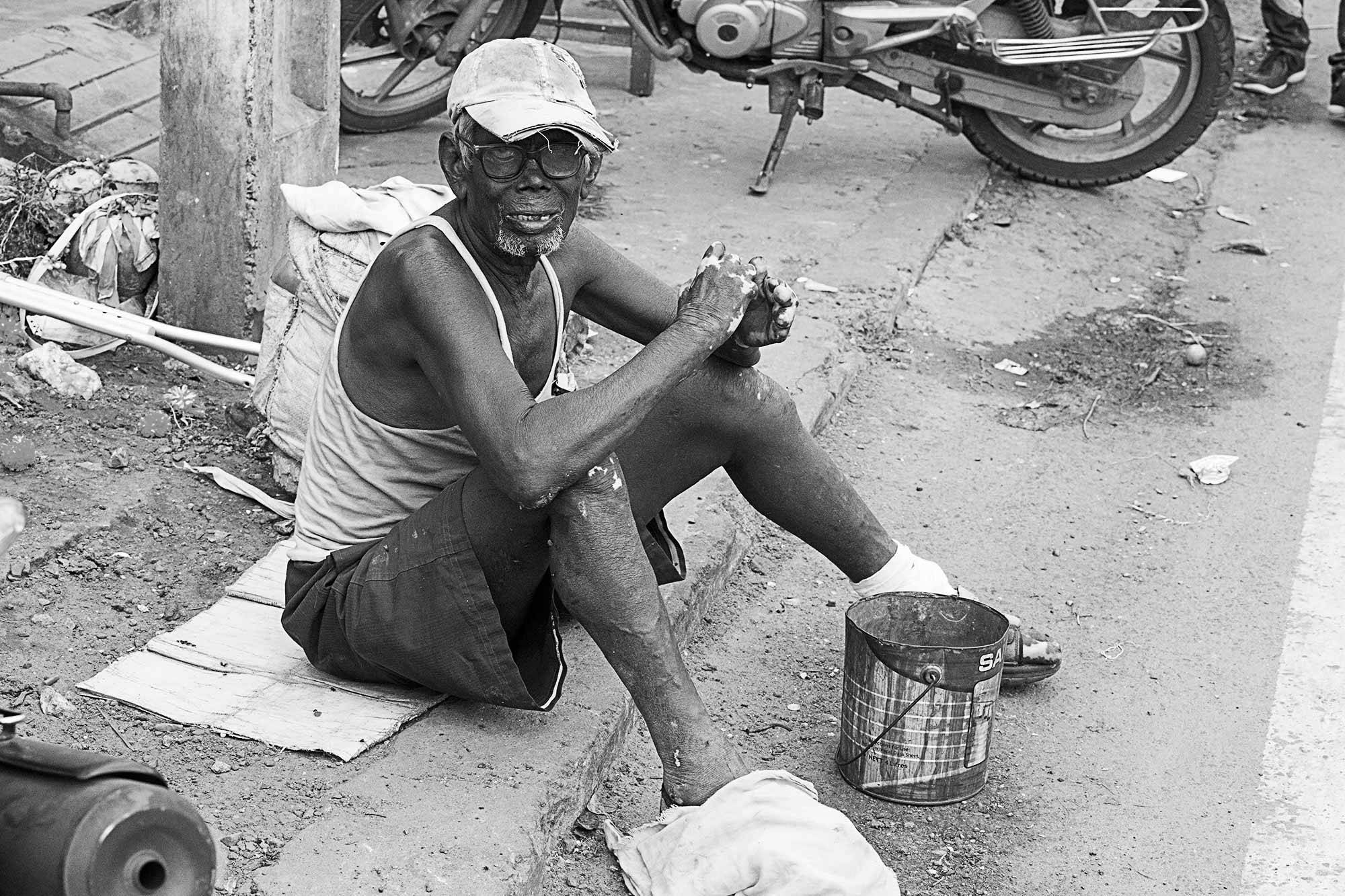 disfigured-man-visakhapatnam-india-1