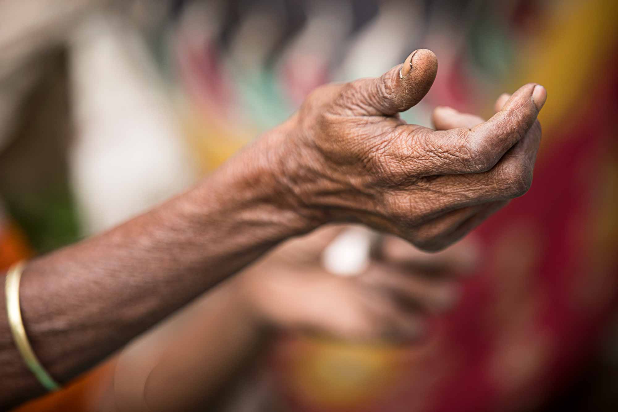 hand-woman-wrinkles-kolkata-india